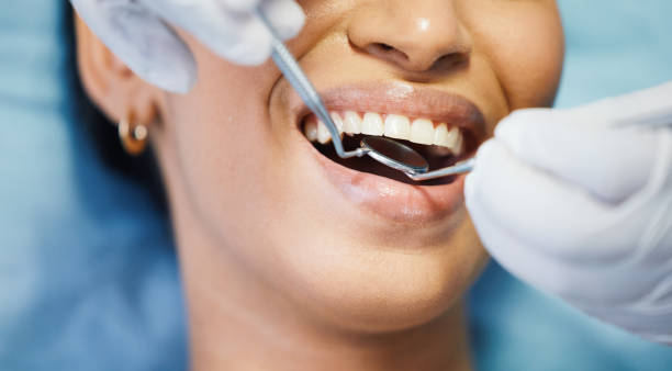 Best Emergency Root Canal Treatment in Pelican Bay, FL